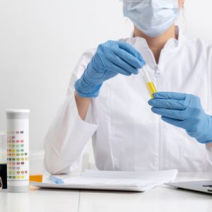 Hormone Profile Test